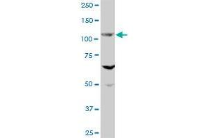 EVC MaxPab polyclonal antibody. (EVC 抗体  (AA 1-535))