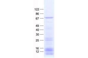 Western Blotting (WB) image for Dynein, Cytoplasmic 1, Light Intermediate Chain 1 (DYNC1LI1) protein (His tag) (ABIN2719874)