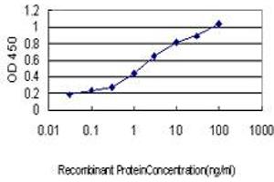 Detection limit for recombinant GST tagged IRF1 is approximately 0. (IRF1 抗体  (AA 216-325))