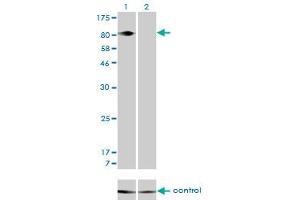 Western blot analysis of ITGB5 over-expressed 293 cell line, cotransfected with ITGB5 Validated Chimera RNAi (Lane 2) or non-transfected control (Lane 1). (Integrin beta 5 抗体  (AA 421-516))