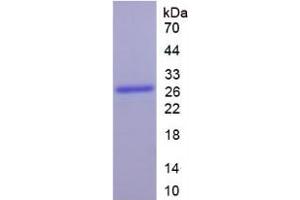 SDS-PAGE analysis of Human Cytochrome P450 1A1 Protein. (CYP1A1 蛋白)