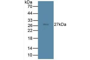 Western blot analysis of Rat Spleen Tissue. (TMEM27 抗体  (Leu222))
