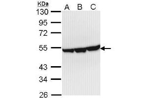 WB Image Sample (30 ug of whole cell lysate) A: Hep G2 , B: Molt-4 , C: Raji 10% SDS PAGE antibody diluted at 1:1000 (ENO3 抗体)