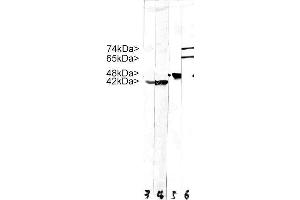 Strip blots of crude HeLa cell extract stained with MCS-4C4. (Lamin A/C 抗体)