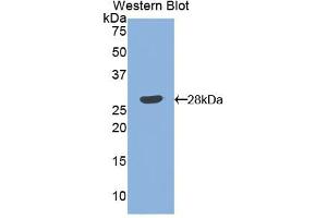 Western blot analysis of the recombinant protein. (Angiopoietin 1 抗体  (AA 266-497))
