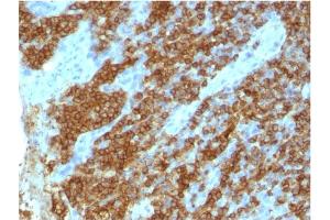 Formalin-fixed, paraffin-embedded human tonsil stained with CD45RA Mouse Monoclonal Antibody (111-1C5) (CD45 抗体)