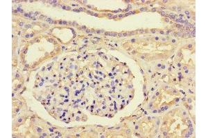 Immunohistochemistry (IHC) image for anti-General Transcription Factor IIB (GTF2B) (AA 1-316) antibody (ABIN7172662)