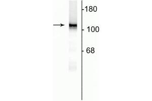 Western Blotting (WB) image for anti-Glutamate Receptor, Ionotropic, N-Methyl D-Aspartate 1 (GRIN1) (AA 1-564) antibody (ABIN361405)