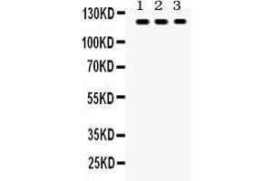 Anti- TLR7 Picoband antibody, Western blottingAll lanes: Anti TLR7  at 0. (TLR7 抗体  (C-Term))