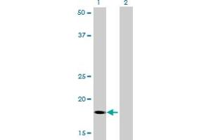 Western Blot analysis of RNF181 expression in transfected 293T cell line by RNF181 monoclonal antibody (M01), clone 5A7. (RNF181 抗体  (AA 90-153))