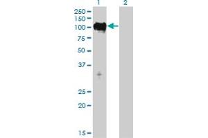 Western Blot analysis of TTK expression in transfected 293T cell line by TTK monoclonal antibody (M01), clone 3G7. (Mps1 抗体  (AA 1-176))