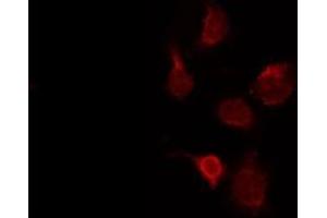ABIN6273991 staining Hela by IF/ICC. (TUBA4A 抗体  (N-Term))