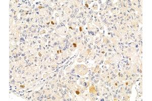 Anillin Antibody at 1/100 staining Rat stomach tissue by IHC-P. (Anillin 抗体  (C-Term))