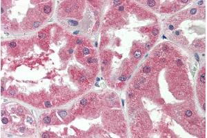 ABIN870684 (5µg/ml) staining of paraffin embedded Human Kidney. (SLC47A2 抗体  (Internal Region))