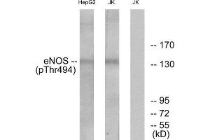 Western Blotting (WB) image for anti-Nitric Oxide Synthase 3 (Endothelial Cell) (NOS3) (pThr494) antibody (ABIN1847469) (ENOS 抗体  (pThr494))