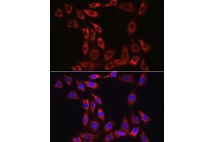 Immunofluorescence analysis of NIH/3T3 cells using IL15RA Rabbit pAb (ABIN3017117, ABIN1680439 and ABIN7101500) at dilution of 1:100 (40x lens). (IL15RA 抗体  (AA 31-205))