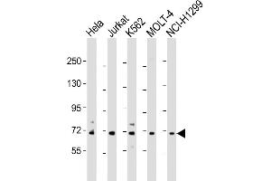 Western Blot at 1:2000 dilution Lane 1: Hela whole cell lysate Lane 2: Jurkat whole cell lysate Lane 3: K562 whole cell lysate Lane 4: MOLT-4 whole cell lysate Lane 5: NCI-H1299 whole cell lysate Lysates/proteins at 20 ug per lane. (NUP85 抗体  (AA 163-195))
