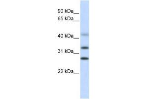 CENPH antibody used at 1 ug/ml to detect target protein. (CENPH 抗体  (Middle Region))