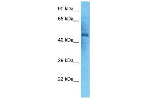 Host:  Rabbit  Target Name:  NEK2  Sample Type:  Thyroid Tumor lysates  Antibody Dilution:  1. (NEK2 抗体  (N-Term))