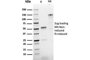 SDS-PAGE Analysis Purified NGFR Rabbit Recombinant Monoclonal Antibody (NGFR/1997R). (Recombinant NGFR 抗体)
