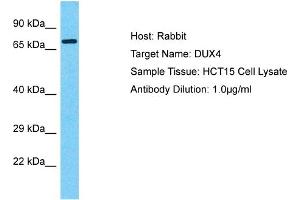 Host: Rabbit Target Name: DUX1 Sample Tissue: Human HCT15 Whole Cell  Antibody Dilution: 1ug/ml (DUX4 抗体  (Middle Region))