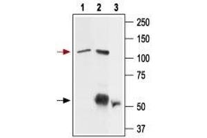 Immunoprecipitation of rat basophilic leukemia (RBL) cell lysate: - 1. (TRPV2 抗体  (1st Extracellular Loop))