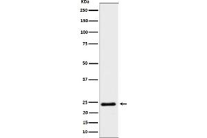 Western blot analysis of Mras expression in HeLa cell lysate.