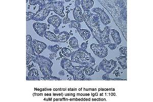 Image no. 1 for anti-Hypoxia Inducible Factor 1, alpha Subunit (Basic Helix-Loop-Helix Transcription Factor) (HIF1A) (AA 329-530) antibody (ABIN363210) (HIF1A 抗体  (AA 329-530))