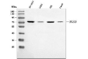 Western blot analysis of RGS9 using anti-RGS9 antibody (ABIN7599945).