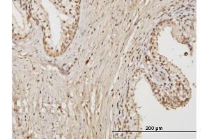 Immunoperoxidase of monoclonal antibody to RAB17 on formalin-fixed paraffin-embedded human prostate. (RAB17 抗体  (AA 1-212))