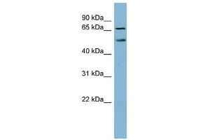 MYST1 antibody used at 1 ug/ml to detect target protein. (MYST1 抗体  (N-Term))