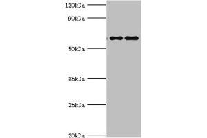 Western blot All lanes: Far upstream element-binding protein 3 antibody at 2 μg/mL Lane 1: Hela whole cell lysate Lane 2: HepG2 whole cell lysate Secondary Goat polyclonal to rabbit IgG at 1/10000 dilution Predicted band size: 62, 29 kDa Observed band size: 62 kDa (FUBP3 抗体  (AA 65-260))