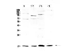 Western blot analysis of IL1F10 using anti-IL1F10 antibody . (IL1F10 抗体  (AA 1-152))