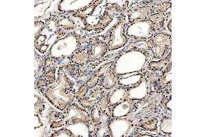 IHC analysis of SNRPD2 using anti-SNRPD2 antibody (ABIN7598963).