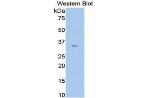 WB of Protein Standard: different control antibodies against Highly purified E. (ANGPTL4 ELISA 试剂盒)