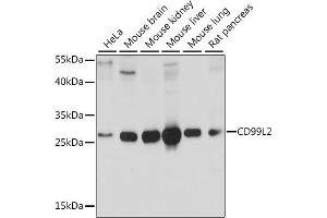 Western blot analysis of extracts of various cell lines, using CD99L2 antibody (ABIN7266229) at 1:1000 dilution. (CD99L2 抗体  (AA 26-185))