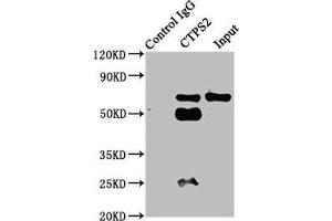 Immunoprecipitating CTPS2 in HepG2 whole cell lysate Lane 1: Rabbit control IgG instead of ABIN7148718 in HepG2 whole cell lysate. (CTPS2 抗体  (AA 62-315))