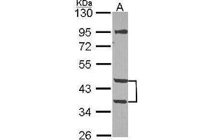 WB Image Sample (30 ug of whole cell lysate) A: NT2D1 10% SDS PAGE antibody diluted at 1:1000 (MPI 抗体)