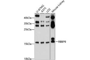 Western blot analysis of extracts of various cell lines, using RBBP9 antibody (ABIN6129095, ABIN6146752, ABIN6146753 and ABIN6220638) at 1:1000 dilution. (RBBP9 抗体  (AA 1-186))