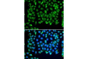 Immunofluorescence analysis of MCF-7 cells using RNF8 antibody. (RNF8 抗体)