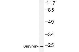 Image no. 1 for anti-Baculoviral IAP Repeat-Containing 5 (BIRC5) antibody (ABIN272115) (Survivin 抗体)