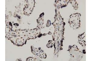 Immunoperoxidase of monoclonal antibody to CARF on formalin-fixed paraffin-embedded human placenta. (CDKN2AIP 抗体  (AA 1-579))
