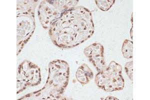 Immunohistochemistry of paraffin-embedded Human placenta using Phospho-PRKAA1(T183)/PRKAA2(T172) Polyclonal Antibody at dilution of 1:100 (40x lens). (PRKAA1 抗体  (pThr172, pThr183))