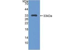 Detection of Recombinant CENPH, Mouse using Polyclonal Antibody to Centromere Protein H (CENPH) (CENPH 抗体  (AA 28-241))