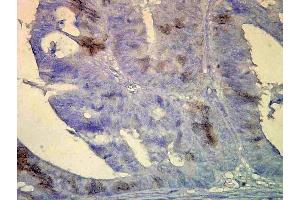 Immunohistochemistry analysis using Mouse Anti-Hsp70 Monoclonal Antibody, Clone BB70 . (HSP70/HSC70 抗体  (APC))