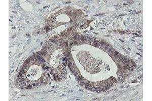 Immunohistochemistry (IHC) image for anti-OTU Domain, Ubiquitin Aldehyde Binding 1 (OTUB1) antibody (ABIN1499930)