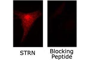 Immunofluorescence staining of STRN on NIH/3T3 cells with or without blocking peptide with STRN polyclonal antibody . (Striatin 抗体)