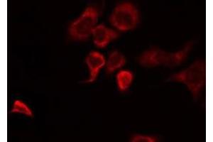 ABIN6274952 staining HuvEc by IF/ICC. (CHST10 抗体  (Internal Region))