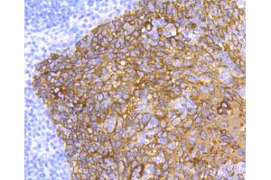 Paraformaldehyde-fixed, paraffin embedded human tonsil, Antigen retrieval by boiling in sodium citrate buffer (pH6) for 15min, Block endogenous peroxidase by 3% hydrogen peroxide for 30 minutes, Blocking buffer at 37°C for 20min, Antibody incubation with Cytokeratin 5 (2H5) Monoclonal Antibody  at 1:50 overnight at 4°C, followed by a conjugated secondary and DAB staining. (Cytokeratin 5 抗体)