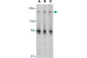 Western blot analysis of IRS1 in PC-3 cell lysate with IRS1 polyclonal antibody  at (A) 1, (B) 2 and (C) 4 ug/mL . (IRS1 抗体  (Internal Region))